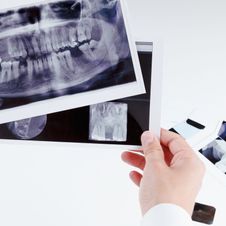 dentista revisando radiografía